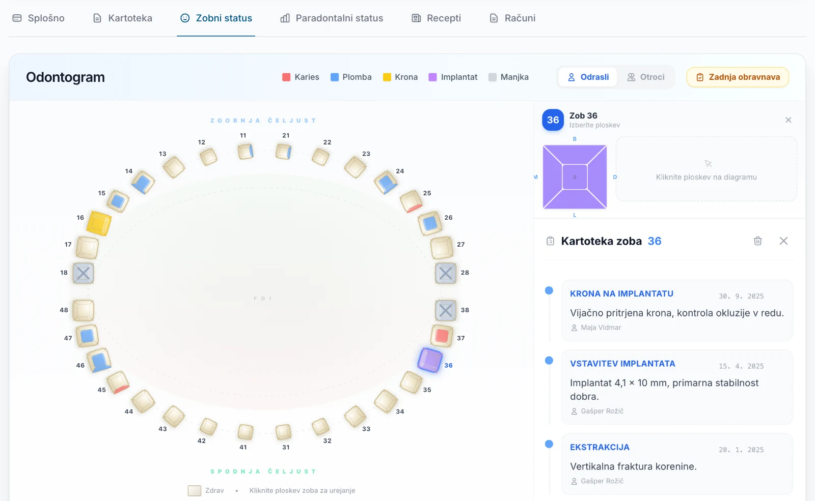 Zobni status z odontogramom in kartoteko zoba 36